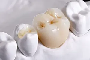 ハイブリット(グラディア)