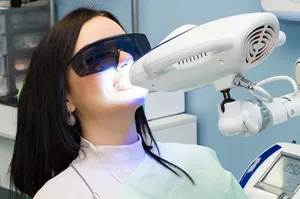 オフィスホワイトニング